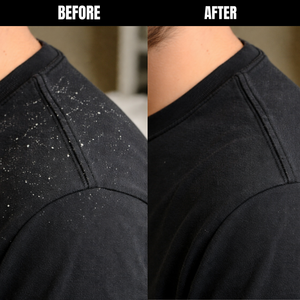 Anti-Dandruff Shampoo for Men that Actually Works.